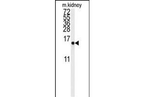 Western blot analysis of anti-LSM1 Antibody (Center) (ABIN389387 and ABIN2839482) in mouse kidney tissue lysates (35 μg/lane). (LSM1 antibody  (AA 33-61))