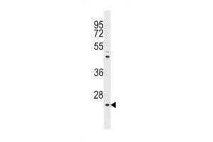 The anti-NeuroG1 N-term Pab  is used in Western blot to detect NeuroG1 in  cell lysate. (Neurogenin 1 antibody  (N-Term))