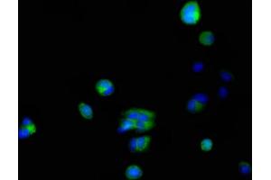 Immunofluorescent analysis of MCF-7 cells using ABIN7156155 at dilution of 1:100 and Alexa Fluor 488-congugated AffiniPure Goat Anti-Rabbit IgG(H+L) (FKBP6 antibody  (AA 101-327))