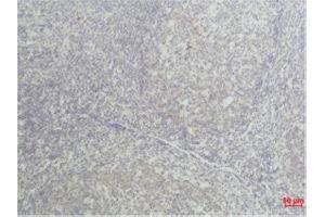 Immunohistochemistry (IHC) analysis of paraffin-embedded Human Tonsil Tissue using TNF a Mouse Monoclonal Antibody diluted at 1:50.