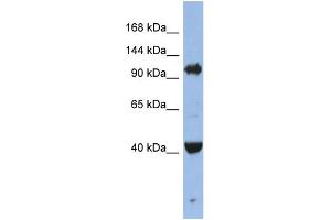 WB Suggested Anti-EIF2C4 Antibody Titration: 0. (AGO4 antibody  (Middle Region))