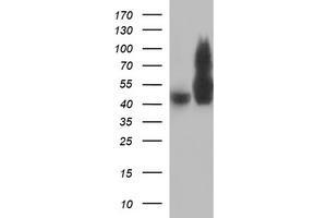 Image no. 1 for anti-Tubulin, beta 2B (TUBB2B) antibody (ABIN1501573) (TUBB2B antibody)