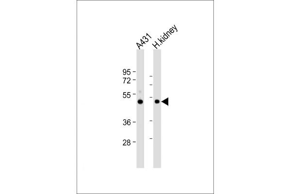 ZMPSTE24 antibody  (AA 400-430)