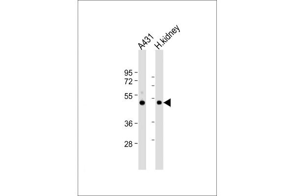 ZMPSTE24 Antikörper  (AA 400-430)