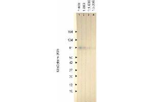 Western Blotting (WB) image for anti-Herpes Simplex Virus Type 1, Glycoprotein C (HSV1 gC) antibody (ABIN265558) (HSV-1 gC antibody)