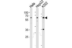 Western blot analysis of lysates from Hela, HepG2, K562 cell line (from left to right), using RIOK3 Antibody (Center) (ABIN6243990 and ABIN6577652). (RIOK3 antibody  (AA 146-179))