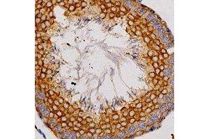 Immunohistochemical analysis of Adenosine A2a Receptor staining in human testis formalin fixed paraffin embedded tissue section. (Adenosine A2a Receptor antibody  (C-Term))