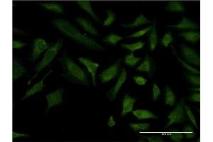 Immunofluorescence of monoclonal antibody to COX6C on HeLa cell. (COX6C antibody  (AA 1-75))