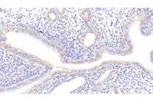 Detection of NFE2L2 in Rat Uterus Tissue using Polyclonal Antibody to Nuclear Factor, Erythroid Derived 2 Like Protein 2 (NFE2L2) (NRF2 antibody  (AA 382-604))