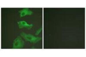 Immunofluorescence analysis of HeLa cells, treated with TNF-a (20nM, 15 mins), using HSP90B (Ab-254) antibody. (HSP9AB1 (Ser254) antibody)