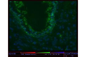 Image no. 2 for anti-Keratin 17 (KRT17) antibody (ABIN335340) (KRT17 antibody)