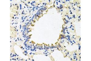 Immunohistochemistry of paraffin-embedded Rat lung using CALU Polyclonal Antibody at dilution of 1:100 (40x lens). (CALU antibody)