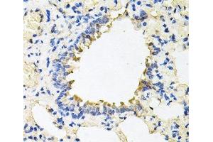 Immunohistochemistry of paraffin-embedded Rat lung using CALU Polyclonal Antibody at dilution of 1:100 (40x lens).