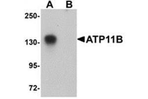 Western blot analysis of ATP11B in K562 cell tissue lysate with ATP11B antibody at 1 μg/ml in (A) the absence and (B) the presence of blocking peptide. (ATP11B antibody  (N-Term))
