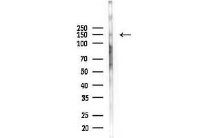 Western blot analysis of lysates from PC12 cells(heat-shock, 45 min treatment), using INSRR Antibody at 1/1000 dilution.