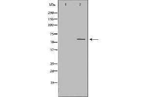 Western blot analysis of extracts of Jurkat using CASP10 Antibody. (Caspase 10 antibody)