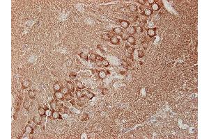 Immunostaining of paraffin embedded sections of mouse hippocampus (dilution 1 : 100).
