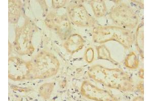 Immunohistochemistry of paraffin-embedded human kidney tissue using ABIN7175887 at dilution of 1:100 (RPGR antibody  (AA 1-180))