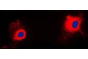 Immunofluorescent analysis of PIG11 staining in HuvEc cells. (TP53I11 antibody  (Center))