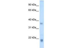Image no. 1 for anti-Growth Hormone 2 (GH2) (C-Term) antibody (ABIN204981)