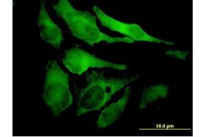 Immunofluorescence (IF) image for anti-Eyes Absent Homolog 2 (Drosophila) (EYA2) (AA 164-271) antibody (ABIN560819)