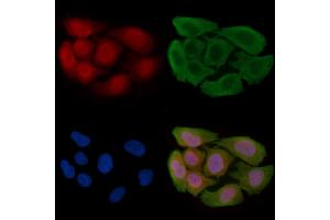 ABIN6256291 and ABIN6267489 staining Hela cells(30 min of UV treatment) by IF/ICC. (Aryl Hydrocarbon Receptor antibody  (pSer36))
