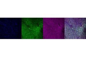 Immunohistochemistry (IHC) image for anti-Calbindin (CALB1) antibody (ABIN7456075) (CALB1 antibody)
