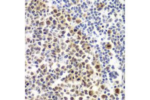 Immunohistochemistry of paraffin-embedded human amygdalitis using MSH6 antibody. (MSH6 antibody)