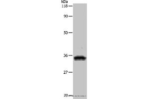 Western blot analysis of 293T cell, using UPK3B Polyclonal Antibody at dilution of 1:1000 (Uroplakin 3B antibody)