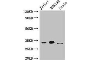 Western Blot Positive WB detected in: Jurkat whole cell lysate, HEK293 whole cell lysate, Mouse brain tissue All lanes: MBD3 antibody at 3 μg/mL Secondary Goat polyclonal to rabbit IgG at 1/50000 dilution Predicted band size: 33, 30 kDa Observed band size: 33 kDa