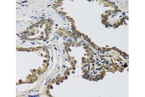 Immunohistochemistry of paraffin-embedded Human prostate using IL25 Polyclonal Antibody at dilution of 1:100 (40x lens). (IL-25 antibody)