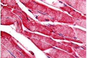 Human Skeletal Muscle (formalin-fixed, paraffin-embedded) stained with PYGM antibody ABIN213350 at 20 ug/ml followed by biotinylated goat anti-rabbit IgG secondary antibody ABIN481713, alkaline phosphatase-streptavidin and chromogen. (PYGM antibody  (C-Term))