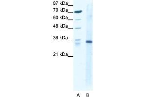 WB Suggested Anti-KLF3 Antibody Titration:  1. (KLF3 antibody  (N-Term))