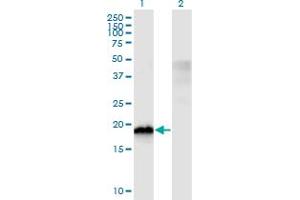Western Blot analysis of CIRBP expression in transfected 293T cell line by CIRBP monoclonal antibody (M03), clone 1C9. (CIRBP antibody  (AA 1-90))