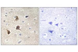 Immunohistochemistry analysis of paraffin-embedded human brain tissue using CD147 antibody. (CD147 antibody  (C-Term))