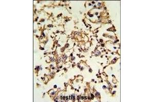 Formalin-fixed and paraffin-embedded human testis tissue reacted with PRKACA Antibody (N-term K82), which was peroxidase-conjugated to the secondary antibody, followed by DAB staining. (PRKACA antibody  (N-Term))