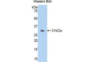 Detection of Recombinant CRP, Mouse using Polyclonal Antibody to C Reactive Protein (CRP) (CRP antibody  (AA 20-225))