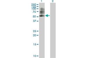 Western Blot analysis of PSMC3 expression in transfected 293T cell line by PSMC3 MaxPab polyclonal antibody. (PSMC3 antibody  (AA 1-439))