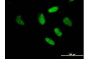 Immunofluorescence of purified MaxPab antibody to RFX3 on HeLa cell. (RFX3 antibody  (AA 1-749))