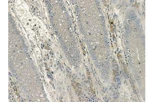 ABIN6256669 and ABIN6267133 at 1/100 staining human normal colon tissue by IHC-P. (LAT antibody  (pTyr200))