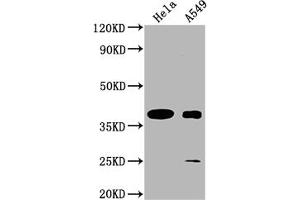 Western Blot Positive WB detected in: Hela whole cell lysate, A549 whole cell lysate All lanes: TAS2R7 antibody at 1:2000 Secondary Goat polyclonal to rabbit IgG at 1/50000 dilution Predicted band size: 37 kDa Observed band size: 37 kDa (TAS2R7 antibody  (AA 151-168))