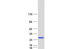 CCDC115 Protein (Myc-DYKDDDDK Tag)