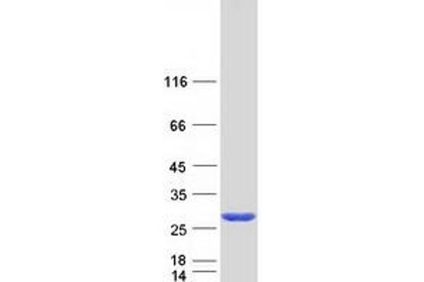 CCDC115 Protein (Myc-DYKDDDDK Tag)