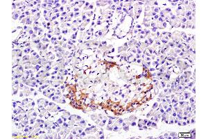 Formalin-fixed and paraffin embedded: rat pancreas tissue labeled with Anti-PP-1B Polyclonal Antibody (ABIN725465), Unconjugated at 1:300 followed by conjugation to the secondary antibody and DAB staining (PPP1CB antibody  (AA 155-250))