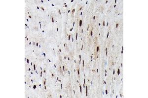 Immunohistochemistry (IHC) image for anti-Forkhead Box O3 (FOXO3) (pSer425) antibody (ABIN7267246)
