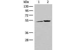 Western blot analysis of K562 cell and Human heart tissue lysates using FECH Polyclonal Antibody at dilution of 1:500 (FECH antibody)