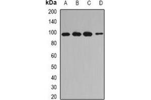 Western blot analysis of INPP4A expression in Jurkat (A), MCF7 (B), mouse testis (C), rat skeletal muscle (D) whole cell lysates. (INPP4A antibody)