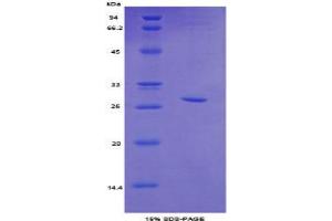 SDS-PAGE analysis of Mouse Topoisomerase II beta Protein.