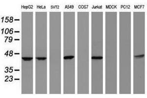 Image no. 3 for anti-Chromobox Homolog 8 (CBX8) (AA 1-260) antibody (ABIN1490660) (CBX8 antibody  (AA 1-260))