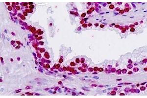 Human Prostate: Formalin-Fixed, Paraffin-Embedded (FFPE) (TSHZ2 antibody  (AA 232-261))